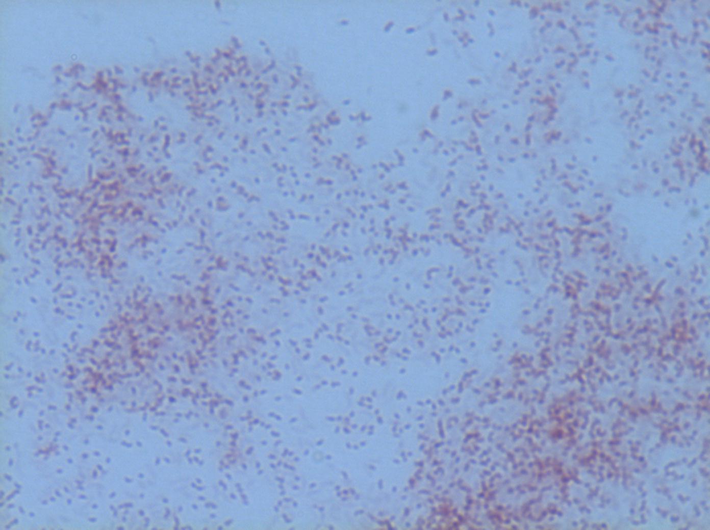 ATCC BAA-2330 Photomicrograph 2