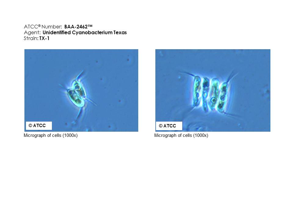 ATCC BAA-2462 Micrograph of Cells