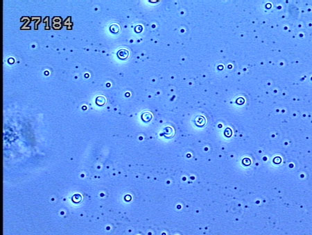 ATCC 27184 Micrograph at 1000X
