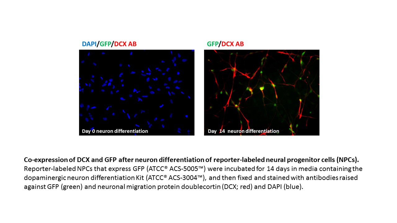 ACS-5005 DCX GFP Expression Overlay