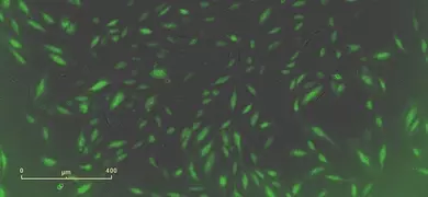 Microscopic image showing green fluorescent cells scattered across a dark background, with a scale bar indicating a range of 0 to 400 micrometers.