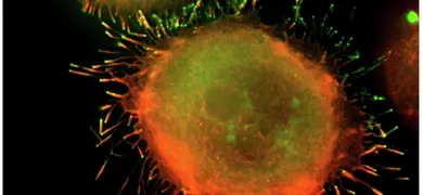 Orange and green K-562 bone marrow cells.