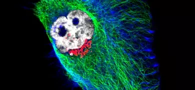 Fluorescent microscopy image of a normal rat kidney cell (NRK-49f) showing a bright nucleus in gray, microtubules in green, and mitochondria in red against a dark background.