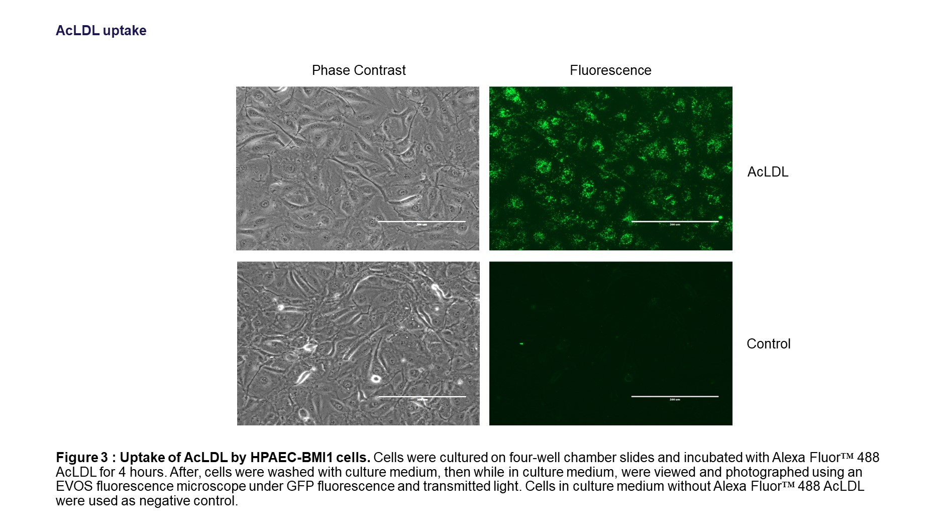 uptake of AcLDL by HPAEC cells