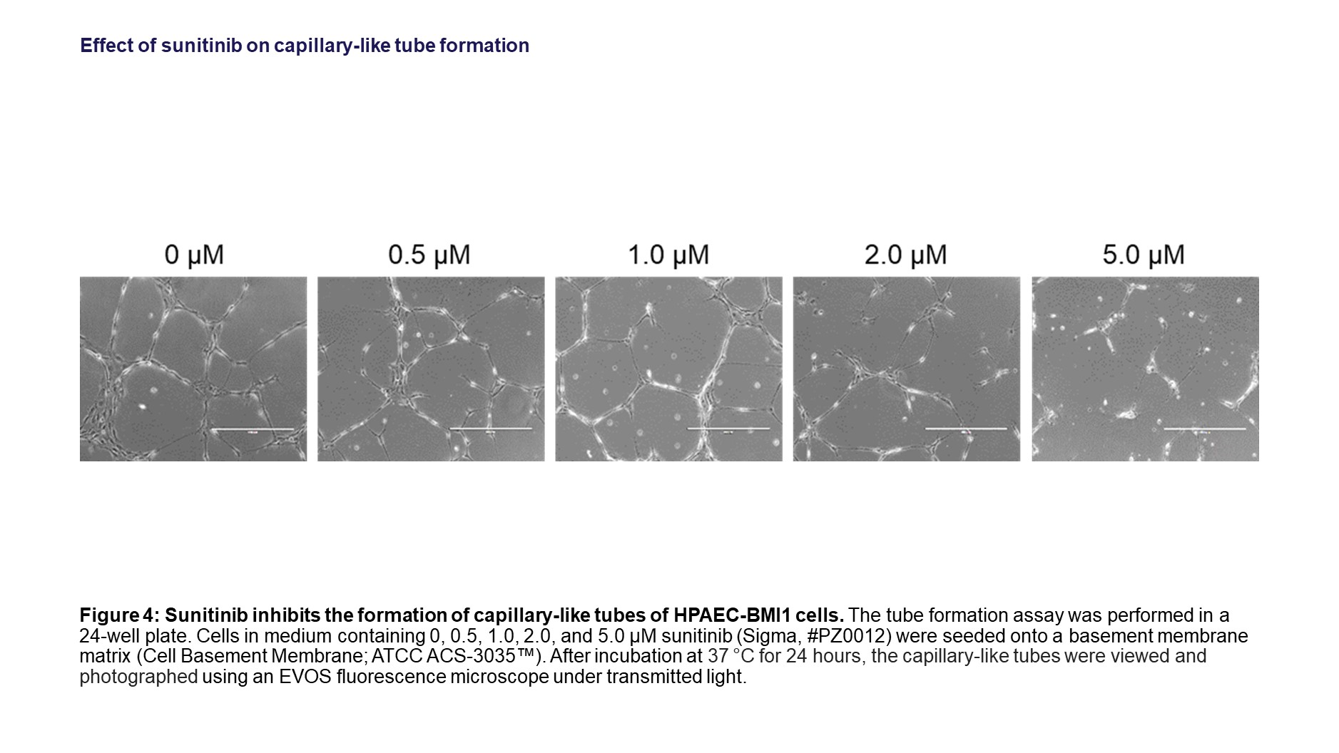 Capillary formation studies of HPAEC-BMI1 cells