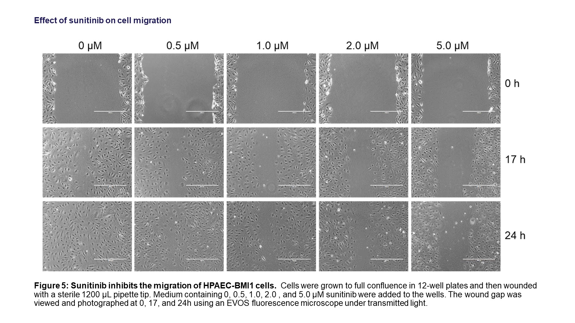 MIgration studies of HPAEC-BMI1 cells