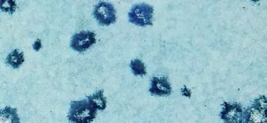 Grainy, dark blue smudges of influenza virus on a light blue background.