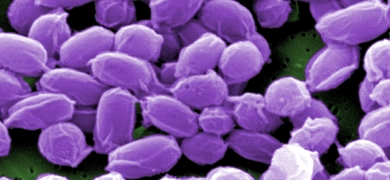 Digitally colorized scanning electron microscope image at 31,207X magnification showing purple endospores of the Sterne strain of Bacillus anthracis with a wrinkled protein coat surface.