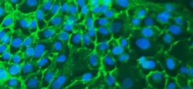 Fluorescent lime green and blue web of  renal proximal tubular epithelial cells.