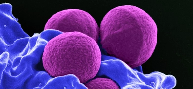 Purple spheres and blue blobs of Methicillin-resistant staphylococcus aureus.