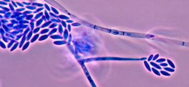 Fusarium verticillioides PHIL_4011_lores CDC Dr. Libero Ajello.jpg
