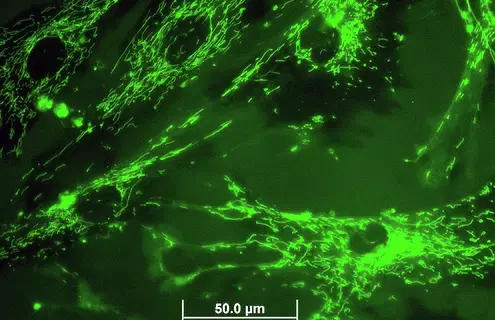 Green fluorescent mitochondria in 895 Sk cells.
