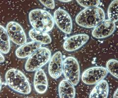 Transparent spheres of blue, white and brown Ciliophora.