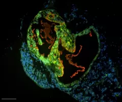 Green, blue and red organoid cells.