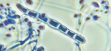 Transparent, floating, blue Trichophyton rubrum fungus.