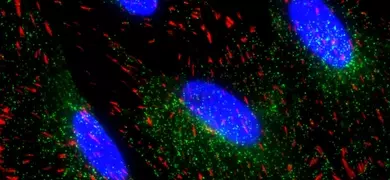Blue retinal pigment end epithelial cells.