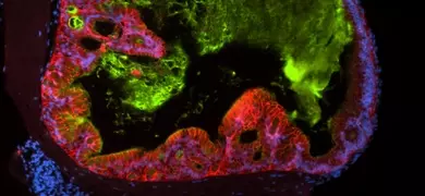 Green, red and blue ECAD IPS cells.