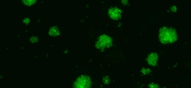 CCL-86-GFP-Luc2_highdensity_GFP.jpg