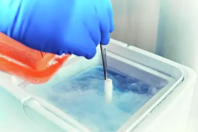 A scientist wearing blue gloves uses tweezers to handle a small cylindrical sample from a container filled with liquid nitrogen, with an orange lid nearby.