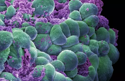 Breast cancer cells courtesy of Annie Cavanagh