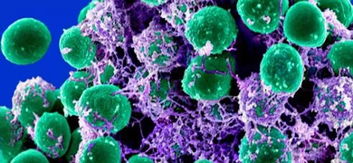 Green floating balls of Staphylococcus epidermidis bacteria tangled with purple tendrils.