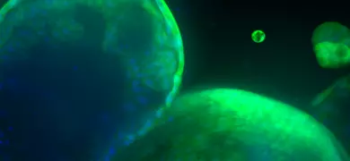 Green organoid from Sanger 10172017