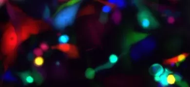 Blurry, fluorescent yellow, red, green, and blue mammary adenocarcinoma cells.