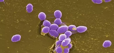 A small group of Gram-positive, Enterococcus faecalis bacteria, formerly known as Streptococcus faecalis