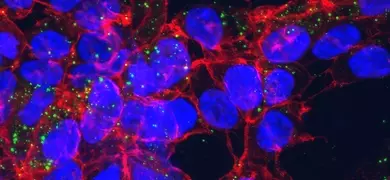 HEK-293 cells showing uptake of polymeric microparticles
