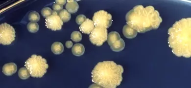 Agar culture plate displaying rough and smooth colonies of Enterobacter cloacae, used in a presentation on defining a new taxonomic species through culturing, photomicrographs, and chemical analysis.