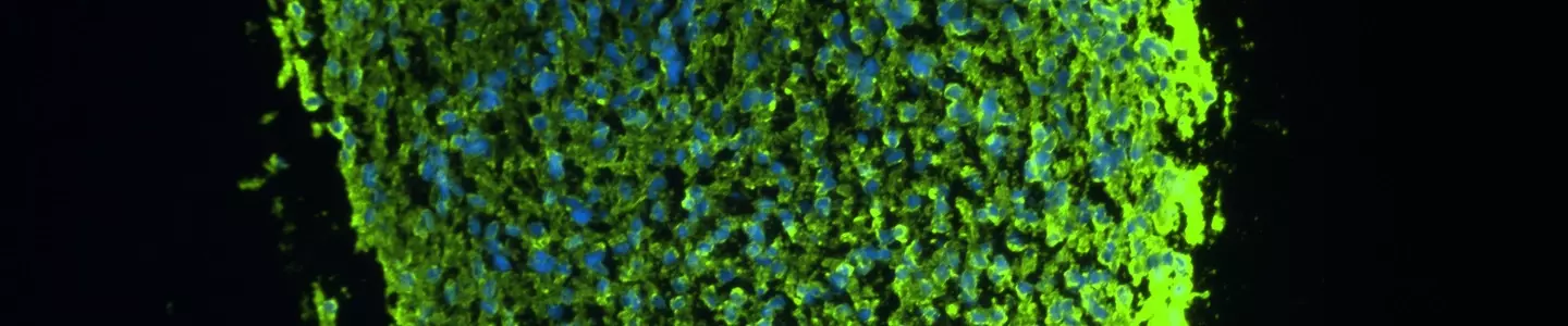 Fluorescence microscopy image showing a large, oval‑shaped three‑dimensional cell spheroid against a black background. The structure is densely packed, with bright green fluorescent signal outlining the outer region and a granular interior containing scattered blue‑stained nuclei. The image highlights the overall size, shape, and layered cellular organization within the multicellular aggregate.