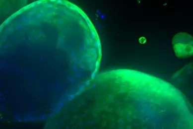 Green organoid from Sanger 10172017