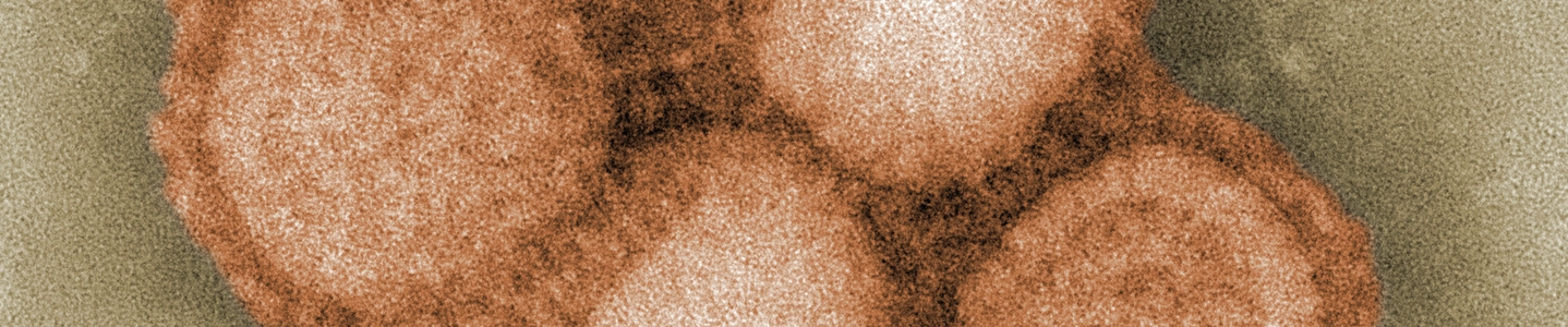 Digitally colorized transmission electron micrograph showing several spherical virions from a 2009 pandemic influenza A (H1N1) virus isolate. The viral particles are clustered together and surrounded by distinct surface spikes, highlighting characteristic structural features of the influenza virus as observed using electron microscopy.