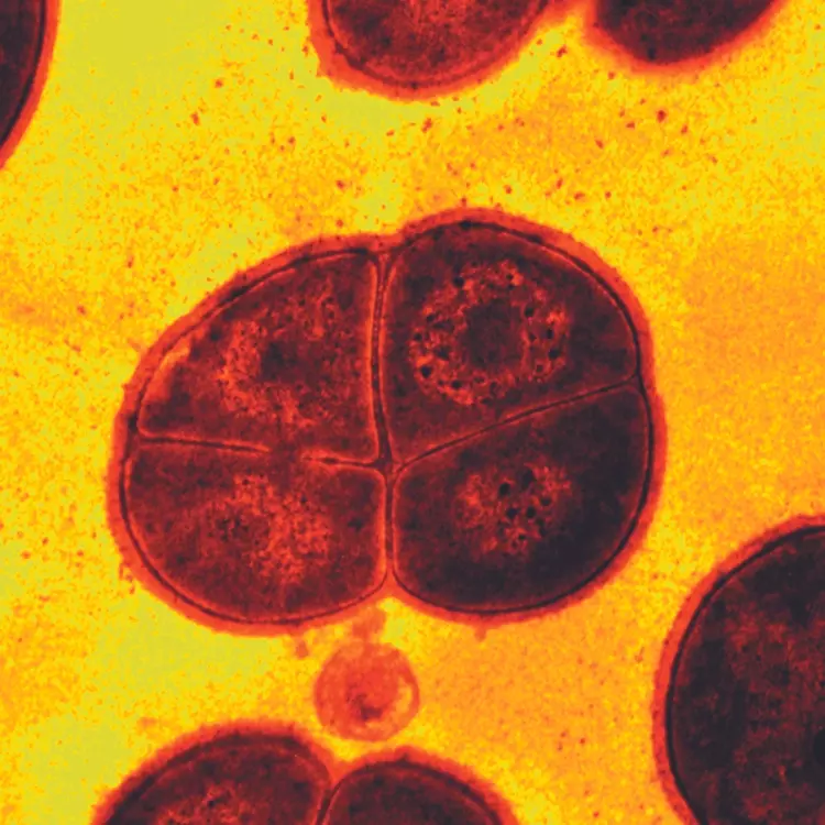 Grainy red and black Deinococcus radiodurans extremophilic bacterium.