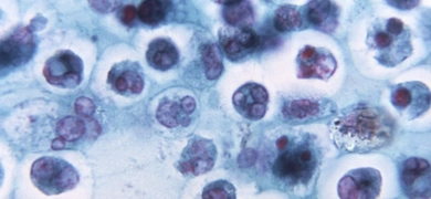Trichrome-stained photomicrograph showing white blood cells (leukocytes) that defend against pathogens and debris.