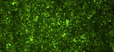 A microscopic image showing green-stained Parkinson's disease cells. The cells are densely packed and exhibit a glowing green fluorescence, highlighting their structure and distribution.