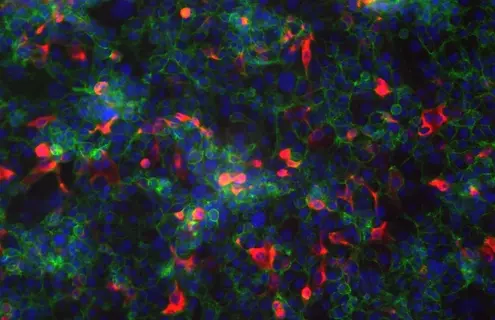  Fluorescent blue, red, and green colon cells
