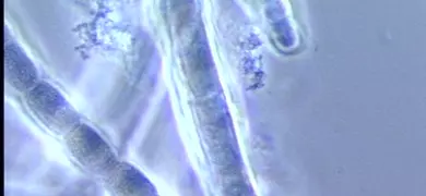 Microscopic image of Calothrix sp. cyanobacteria, showing elongated, filamentous strands with bead-like segments, labeled "ATCC 27914 Calothrix sp." at the top.