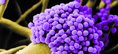 Green stem attached to a cluster of small, round, purple Aspergillus fumigatus.