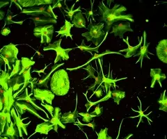 Green Oligodentrocytes neural progenitor cells.
