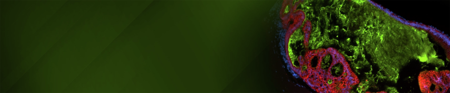 A banner image shows a dense, irregular tissue‑like cellular structure with bright green fluorescence across the main body and red outlining along layered edges, with dark blue and black regions defining the boundaries, set against a green gradient background on the left.