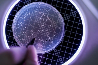 Looking at Petri Dish with Bacteria Culture through magnifying glass