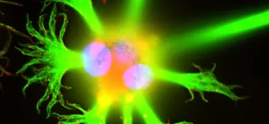 Star fish-shaped, fluorescent lime green, rat brain glioma cell.