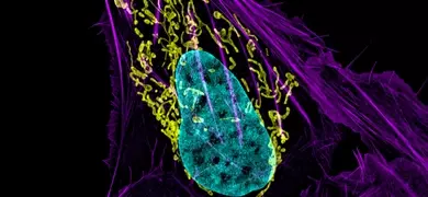 Osteosarcoma cells with DNA in blue, energy factories (mitochondria) in yellow, and actin filaments, part of the cellular skeleton, in purple.