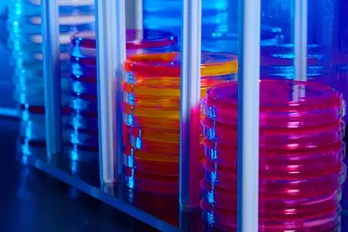 Several stacks of petri dishes containing various colored media, in rack.