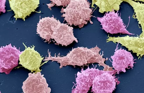 Pink and yellow cancer cells on a blue background.
