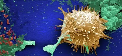 Digitally colorized scanning electron microscopic (SEM) image of an untreated water specimen extracted from a wild stream