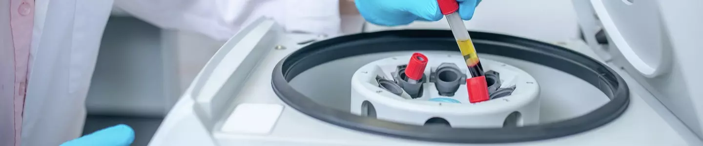 Close up of human hand putting the test tube to centrifuge