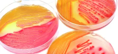 Petri dish bacterial colony iStock-153558550.jpg