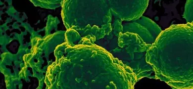 Digitally colorized, scanning electron microscopic (SEM) image, depicts a white blood cell (WBC) known as a neutrophil, as it was in the process of ingesting a number of spheroid shaped, methicillin-resistant, Staphylococcus aureus (MRSA) bacteria.